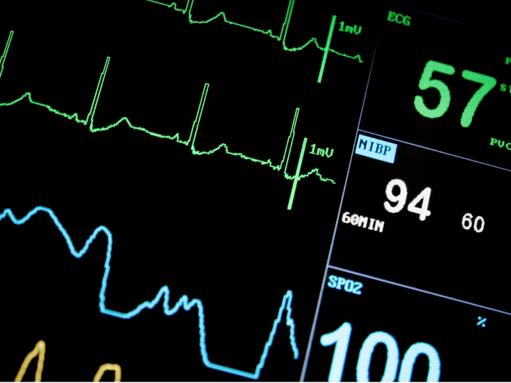 Remote Vital Monitoring